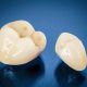 Zirconia Crown